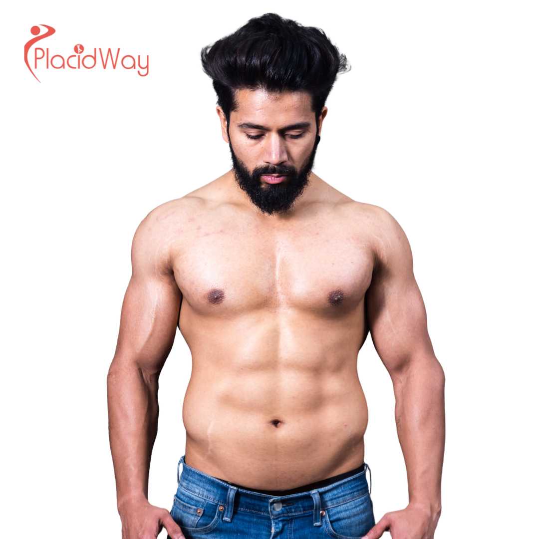 Is Male Breast Reduction Surgery in Guadalajara, Mexico Safe?