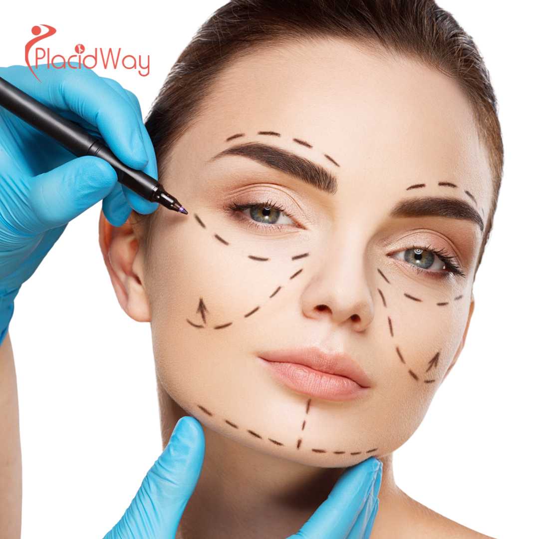 How Much Does V-Line Surgery Cost in South Korea?