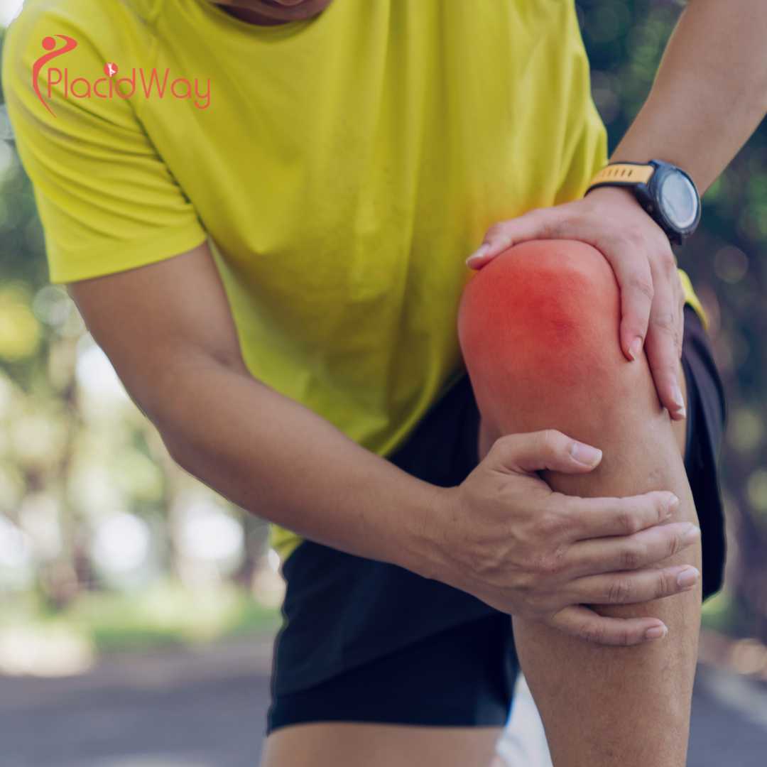 What Results Come From Stem Cell Knee Arthritis Therapy In Malaysia?