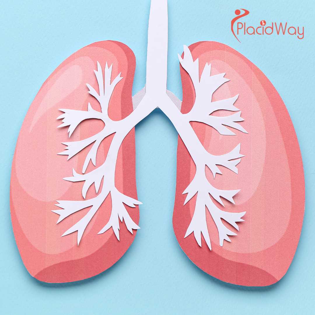 Can Lung Cancer Immunotherapy in Mexico Replace Chemotherapy?