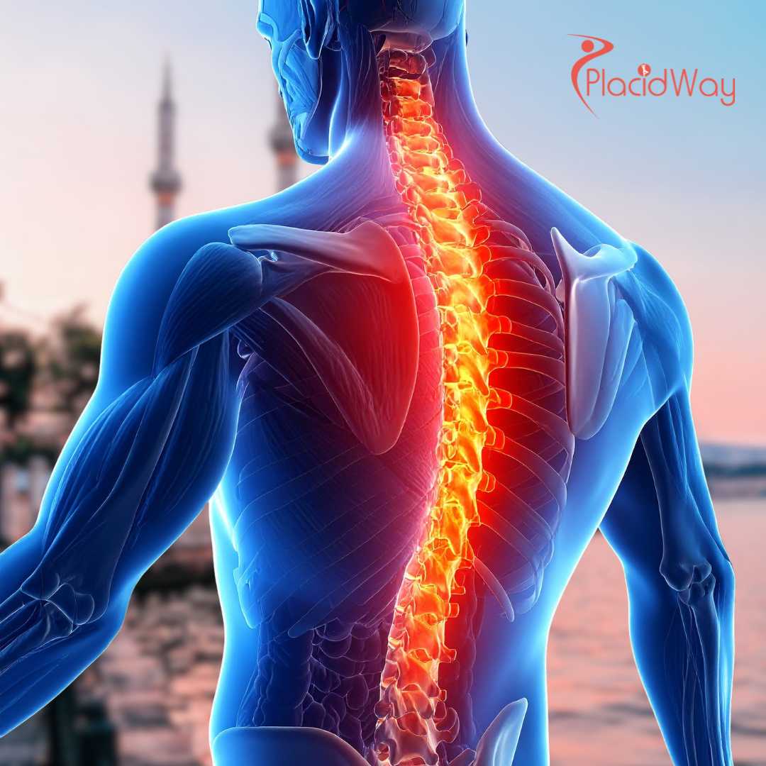 Is Spine Surgery In Turkey Safe And Modern?