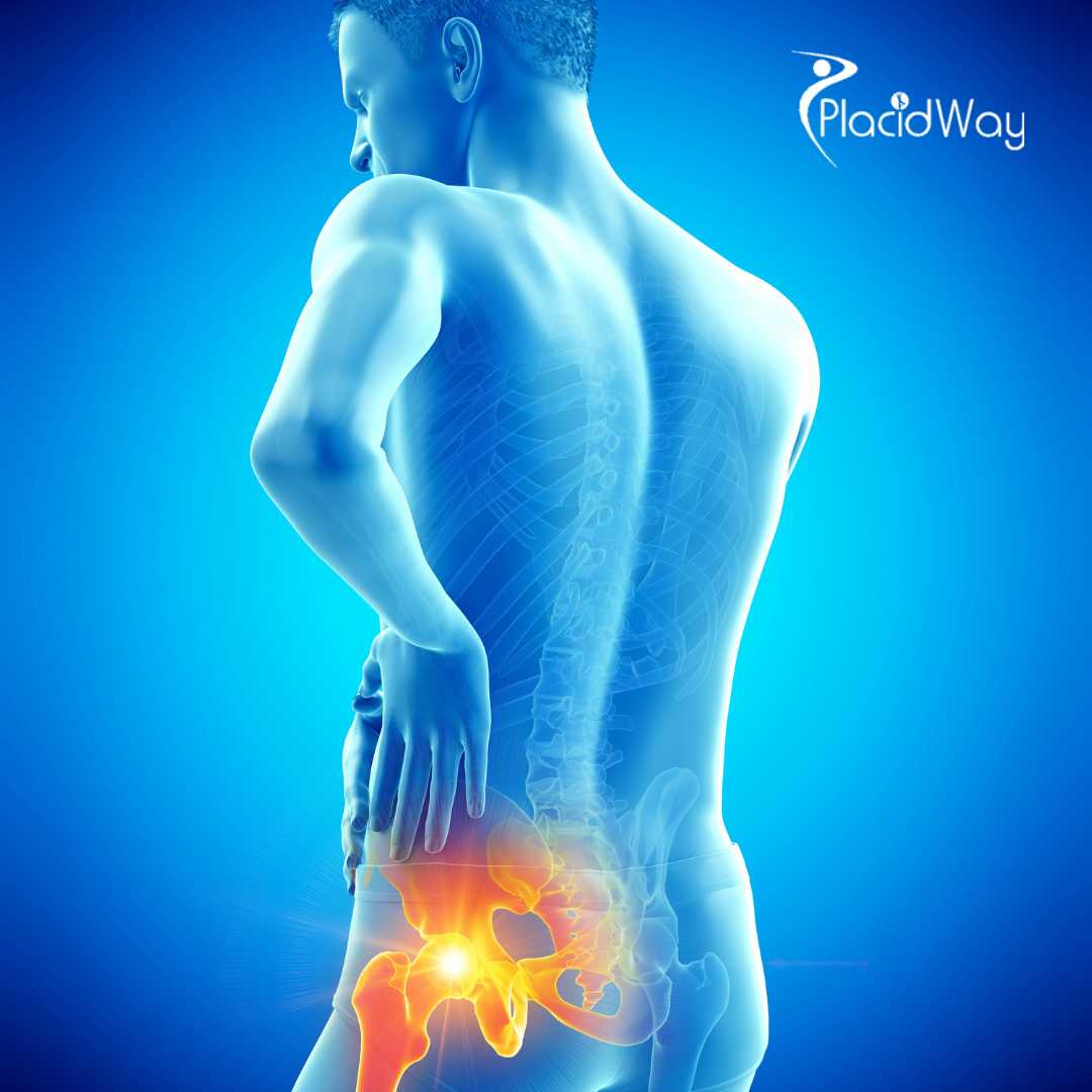 How Advanced Is Hip Replacement Surgery In India?