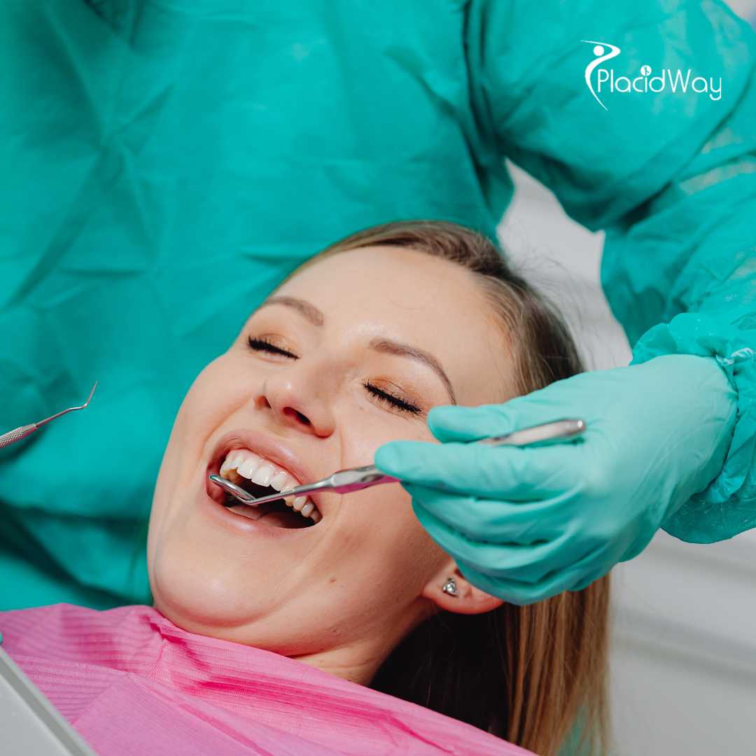 How Long Do Dental Veneers Last When Done In Turkey?