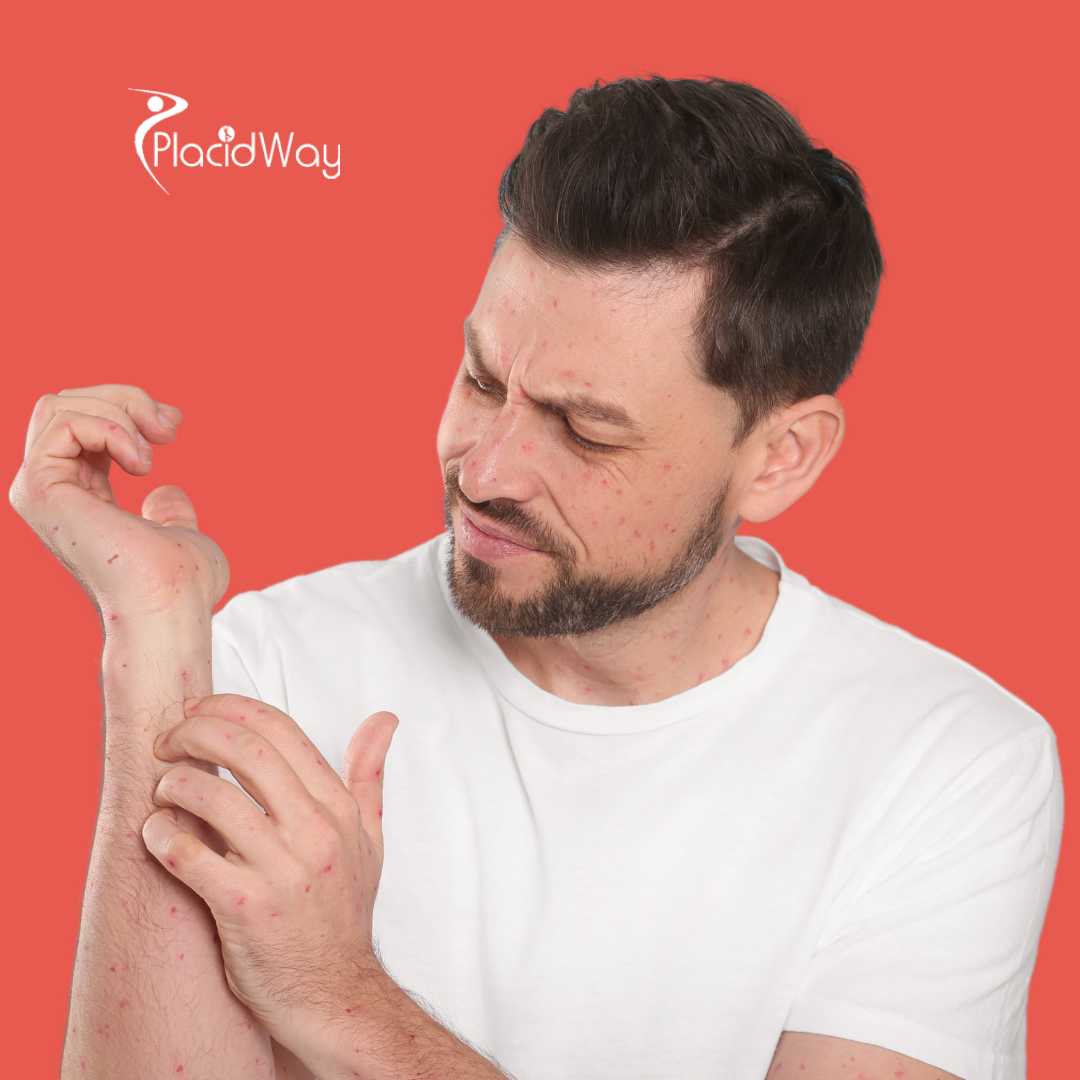 How Much Does Lyme Disease Treatment Cost in Tijuana, Mexico?