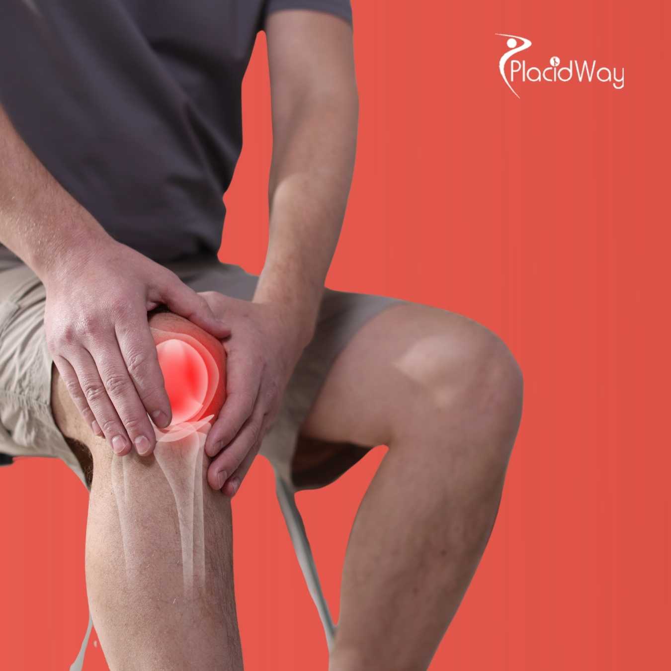 How Are U.S. Patients Using Stem Cell Therapy to Treat Rheumatoid Arthritis Abroad?