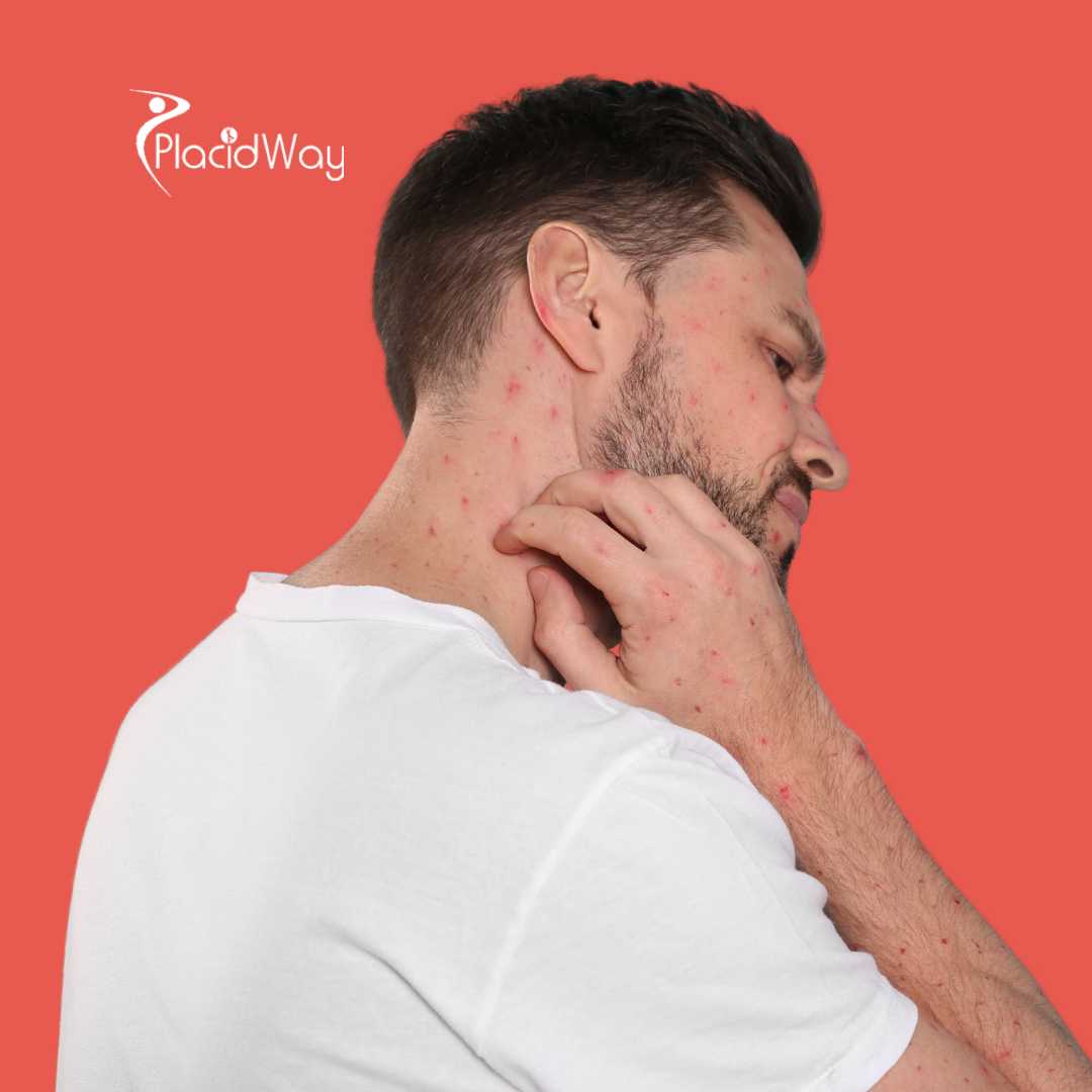 How Long Does Lyme Disease Take to Show Up for US Patients Considering Treatment in Tijuana? 