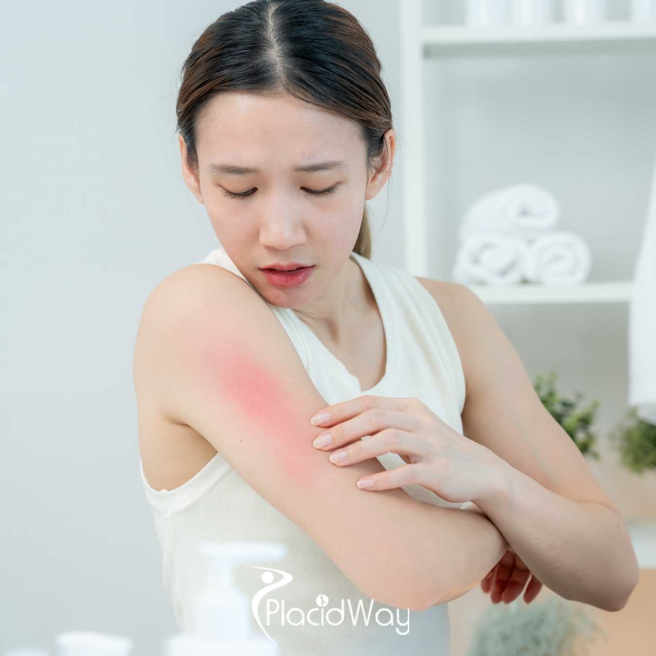 Are US patients finding relief for Systemic Lupus Erythematosus (SLE) in Mexican clinics?