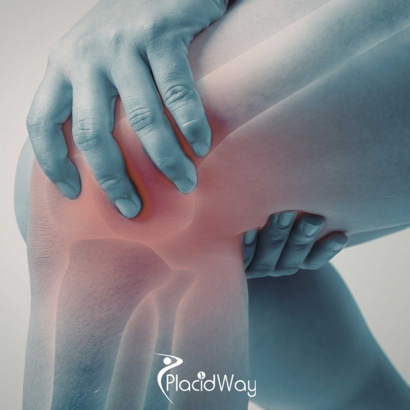 Are Tijuana Cancer Clinics Safe for Canadians Seeking Alternative Bone Cancer Treatments?