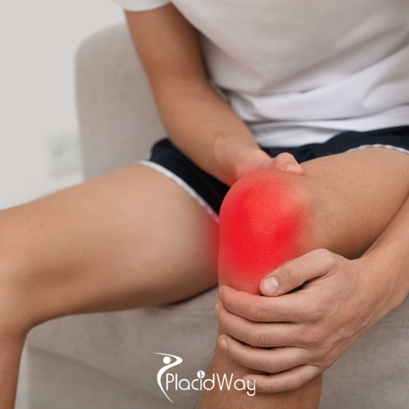 Can Stem Cell Therapy in Mexico Help U.S. Patients Avoid Knee Replacement Surgery?