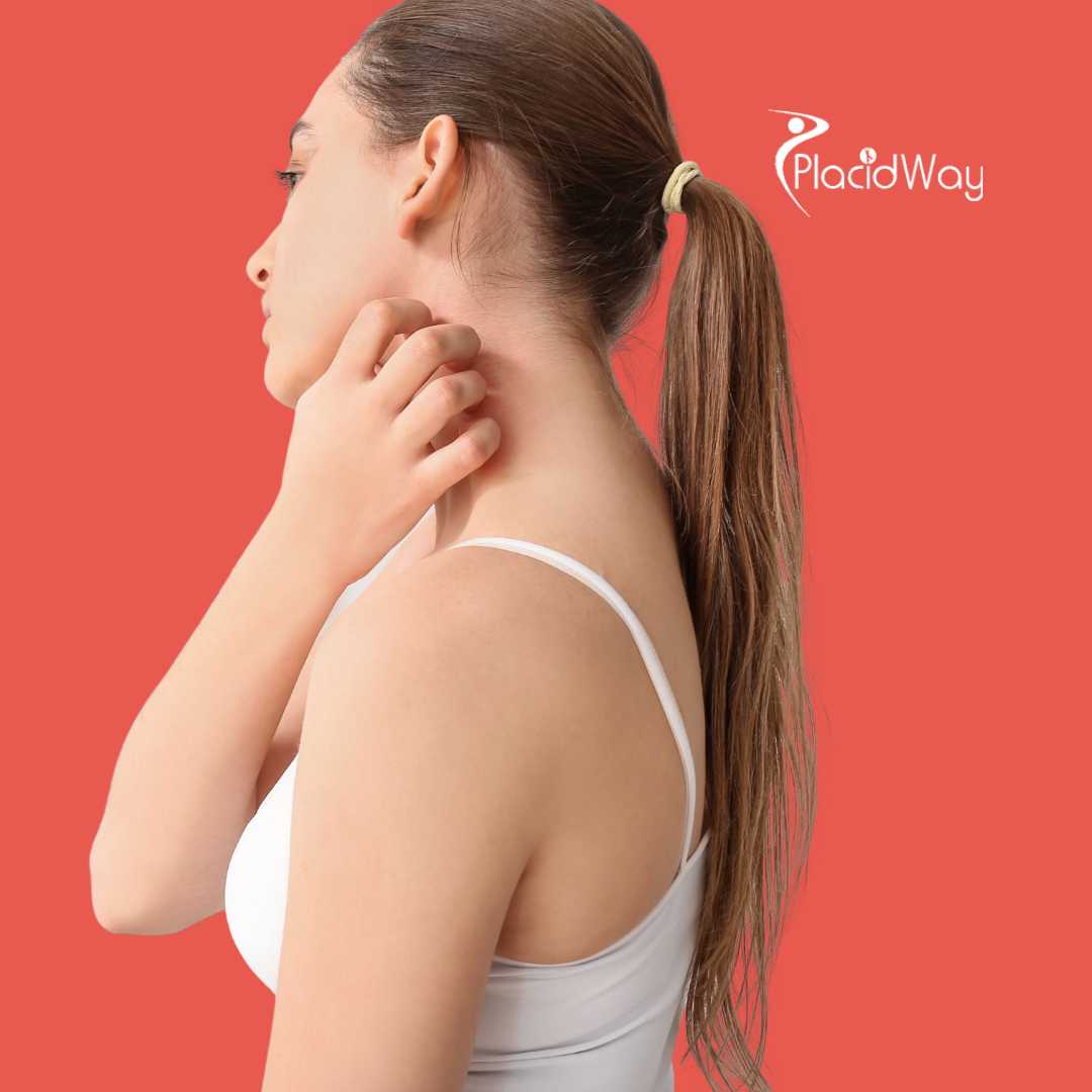 What Are the Early Signs of Lyme Disease?