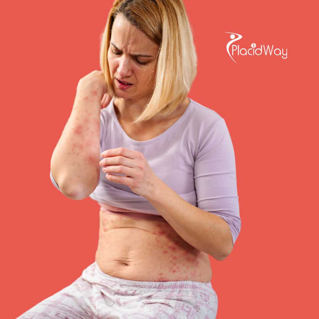 Can I Book Lyme Disease Treatment in Tijuana Without Long Waits?