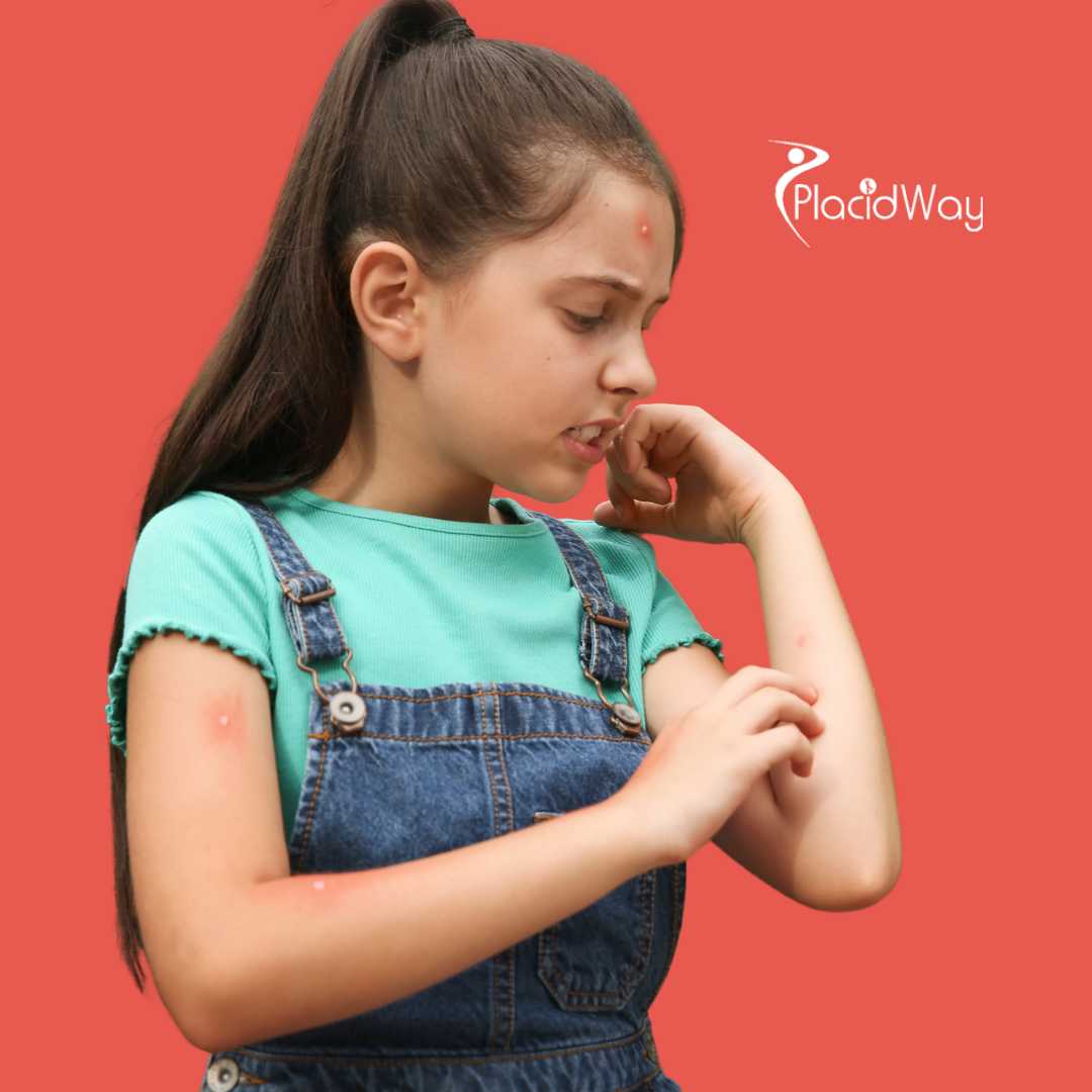 How Long Does Lyme Disease Take to Show Up After a Tick Bite?