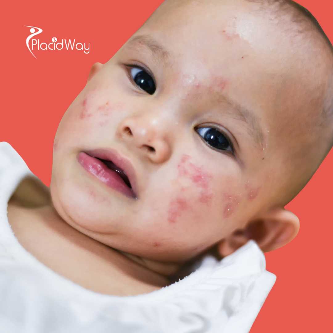 Can Texas Patients Travel to Mexico for Lyme Disease Treatment?