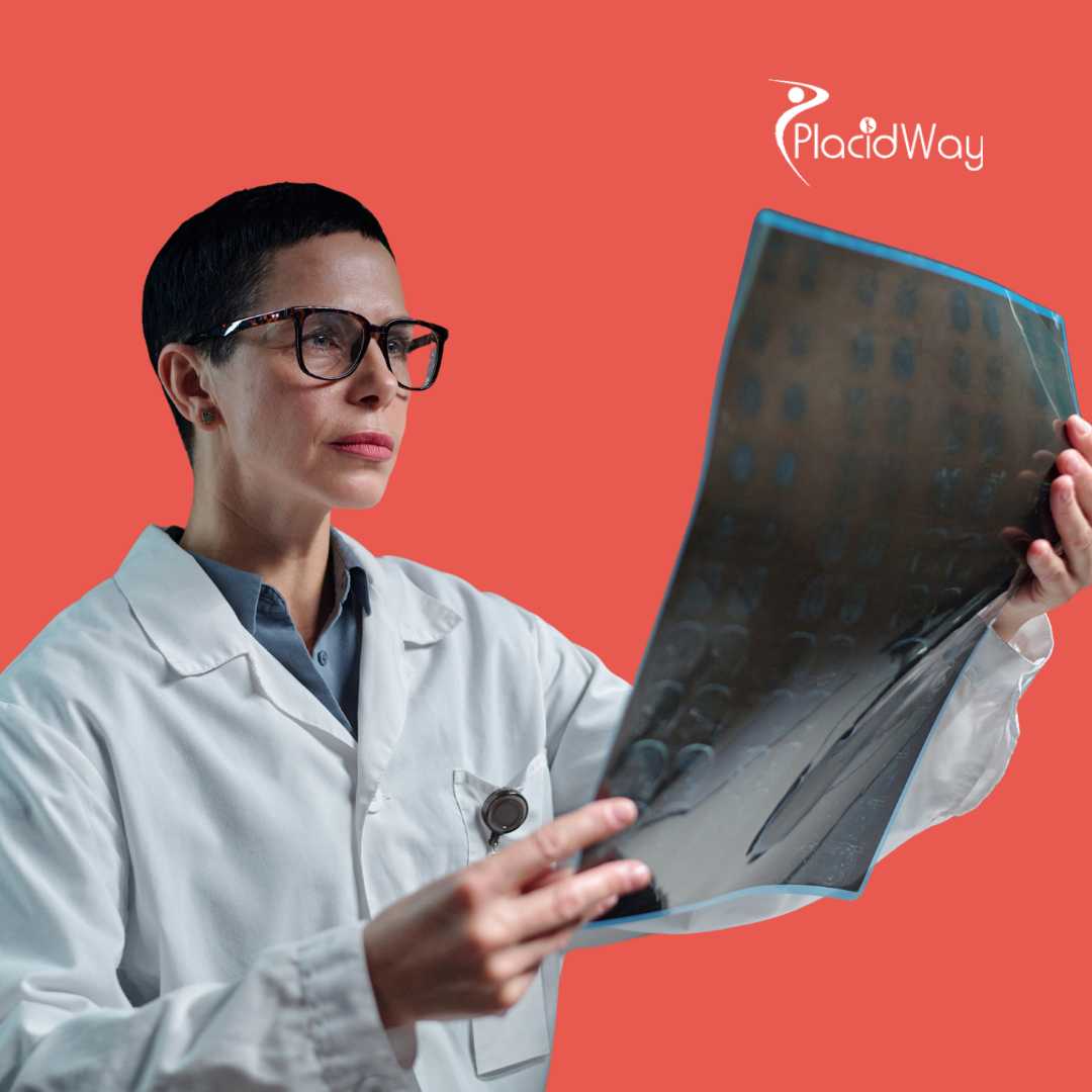 When Additional Imaging Is Needed Before Starting Rectal Cancer Immunotherapy in Mexico?