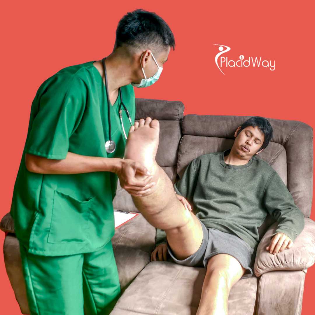 Why U.S. Patients Compare the Total Cost of Limb Lengthening in Turkey Before Booking Abroad