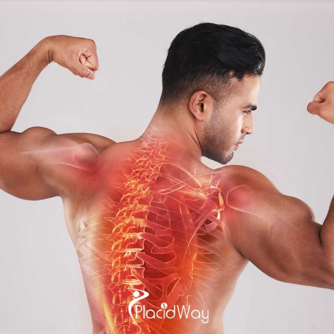 What Is the Success Rate of Stem Cell Treatment for Spinal Cord Injury in Colombia?