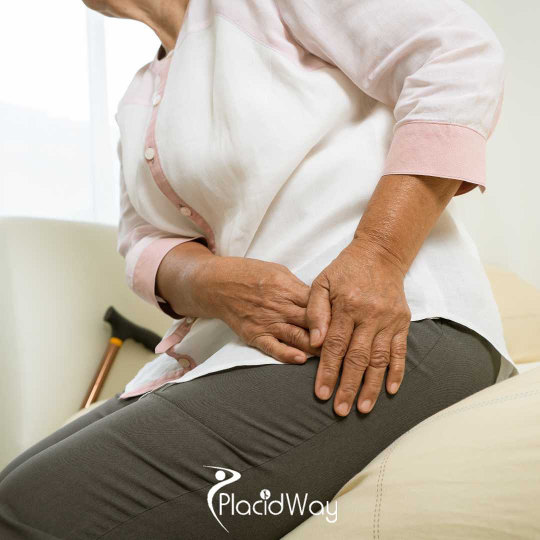 Why Are UAE Patients Choosing Turkey Over Local Hospitals for Total Hip Replacement Surgery?