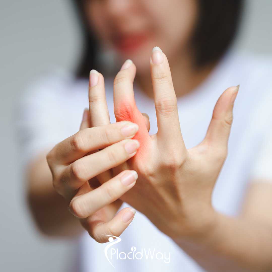 Can Americans With Rheumatoid Arthritis Get Stem Cell Therapy in Puerto Vallarta Mexico?