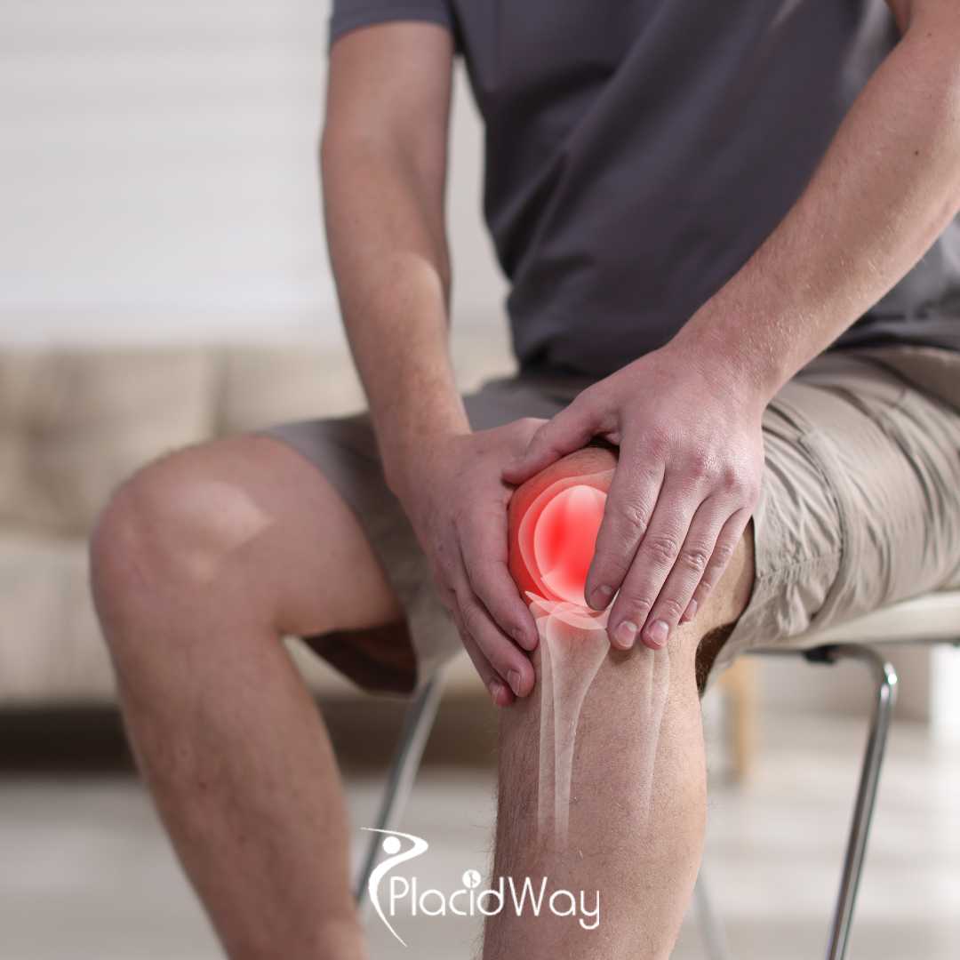 Can I Get a Partial Knee Replacement in Tijuana With US Board Certified Surgeons?