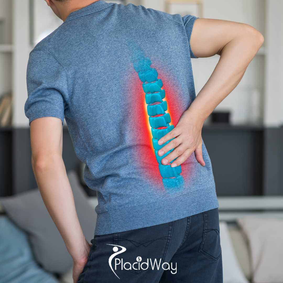 How Long Do I Need to Stay in Mexico After a Lumbar Spinal Fusion Procedure?