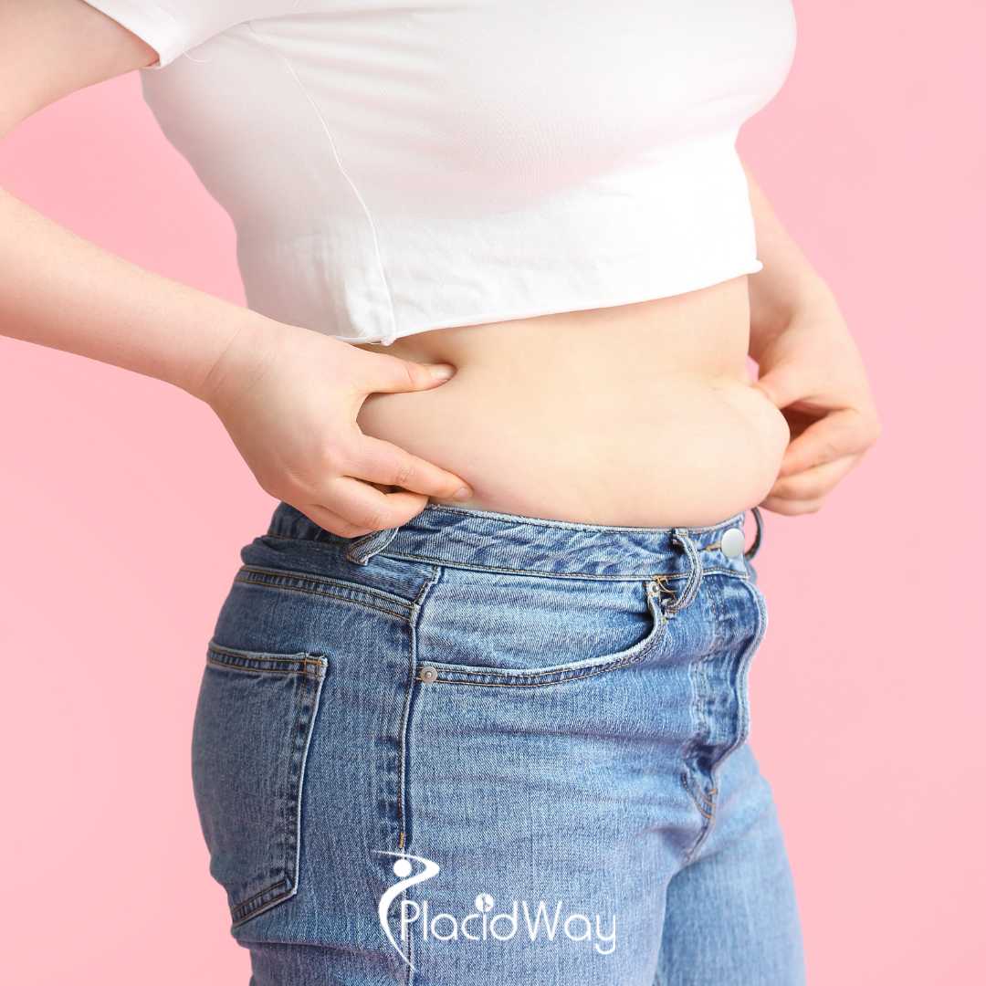 What Do Canadian Patients Need to Know Before Booking a Tummy Tuck in Bogotá Colombia?