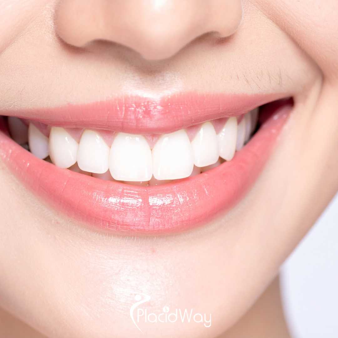 Before and After Dental Crowns in Los Algodones Mexico