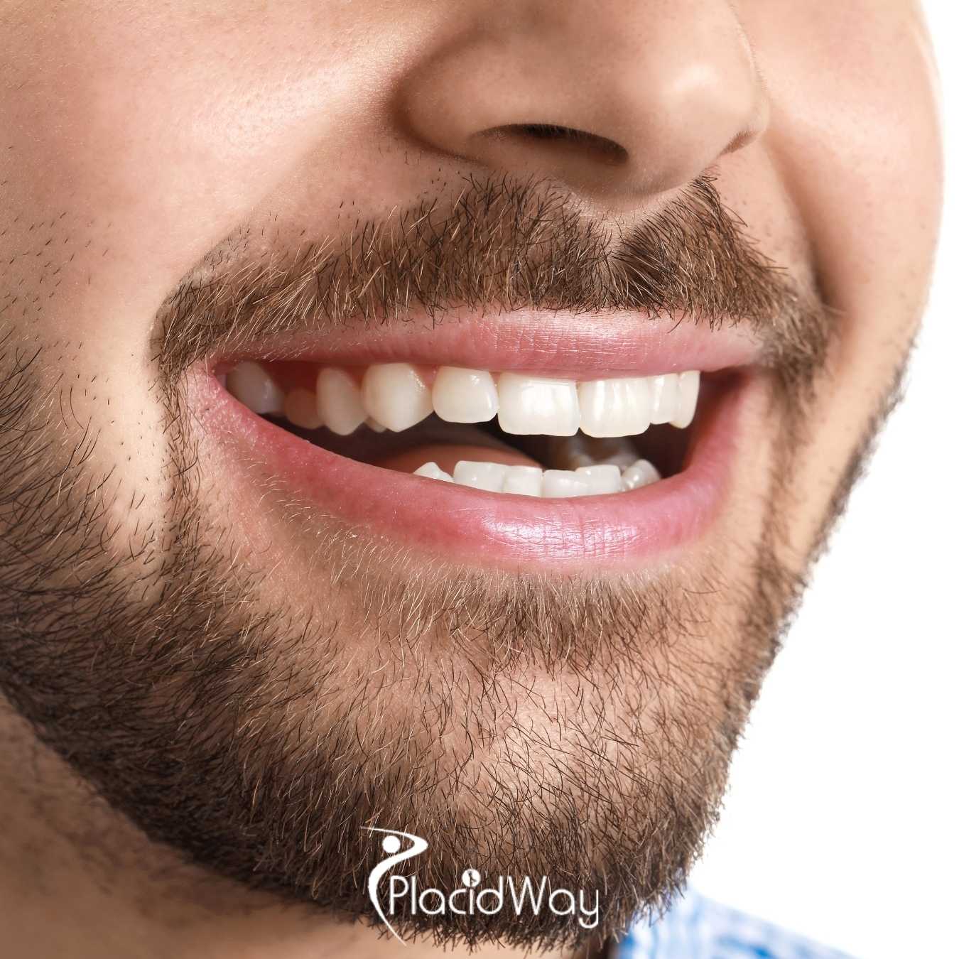Successful Dental Procedure at Sani Dental Group Los Algodones, Mexico