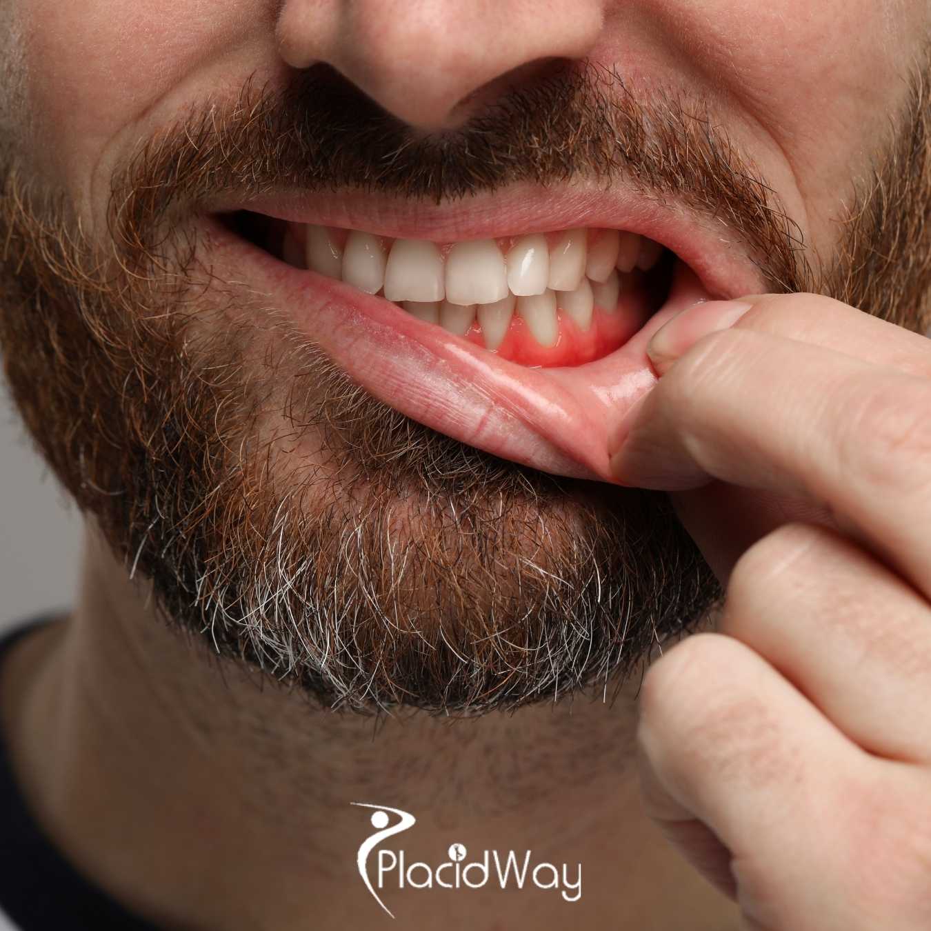 Conozca Sani Dental Group, Los Algodones, México después del trabajo dental