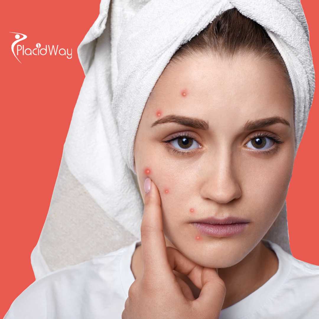 Advanced Alternative Skin Cancer Therapies: Canadian Patient Emma's Renewed Hope in Mexico