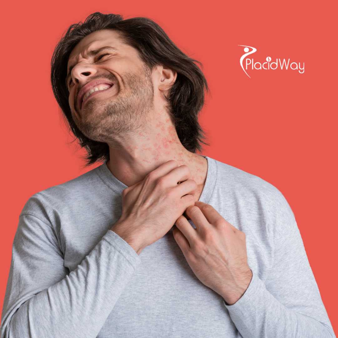 Reclaiming Skin Health: How US Patient Brian Managed Eczema at a Tijuana Immune Clinic