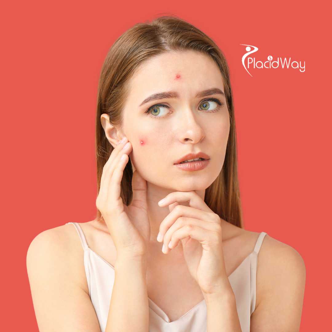 Achieving Skin Balance: How US Patient Jessica Tried Immune-Level Strategies in Mexico