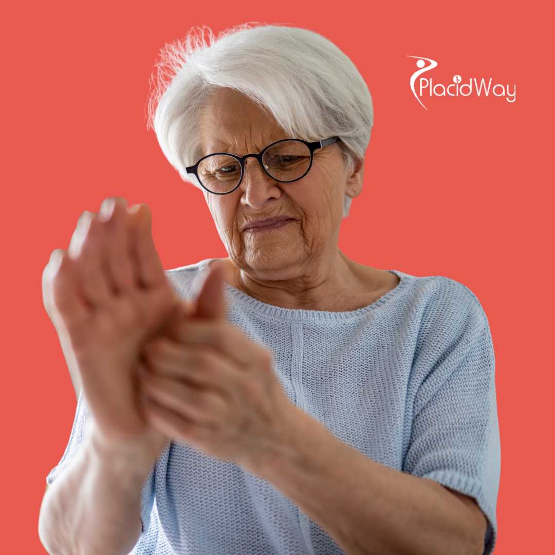 Treating Rheumatoid Arthritis: How US Patient Sarah Used Stem Cell Therapy Abroad