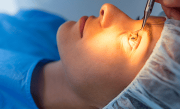 Laser Surgery Medical Tourism