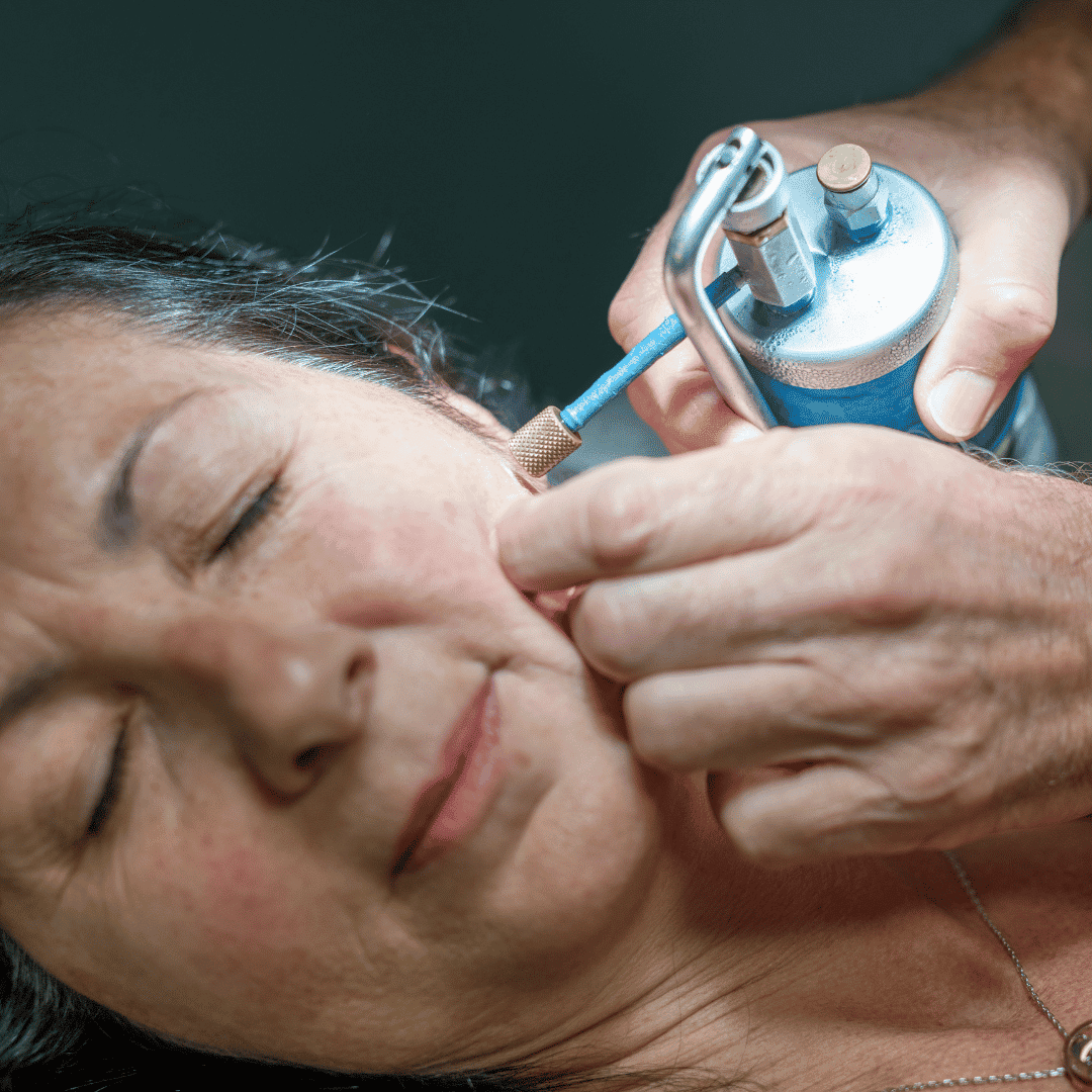 Cryotherapy Medical Tourism