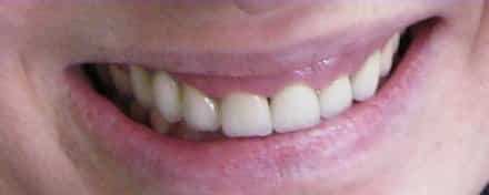 Smile