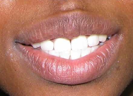 Smile