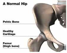 Hip