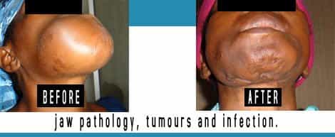 Pathology