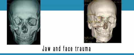 Jaw And Face Trauma