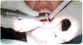 Maxilofacial Surgery