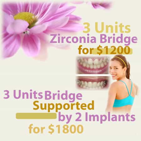Package  Laser Dental Clinic Package