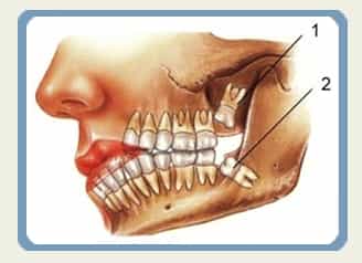 Dentistry Procedure in Istanbul Turkey