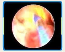 Uromedic Pictures Center