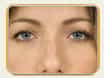 Surg  Perfection Makeover