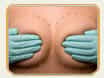 Surg  Perfection Makeover