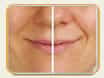 Surg  Perfection Makeover