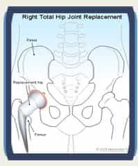Dr Santpure Joint Replacement Pic