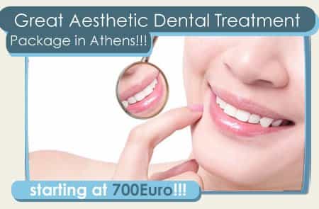 Package Dental Experts