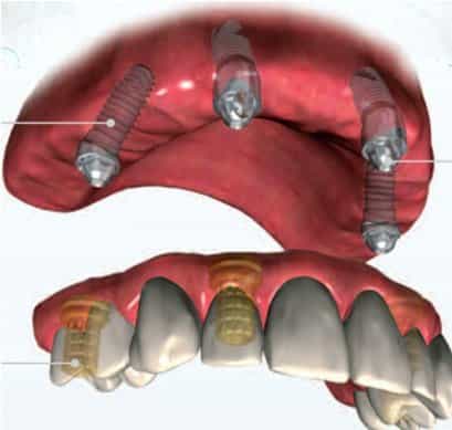 Dentaris Pic  Art