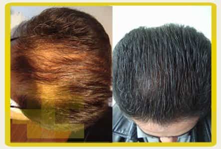 Geovani Bojanini Image Profile Before After